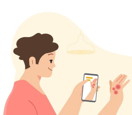 谷歌AI皮肤病检测